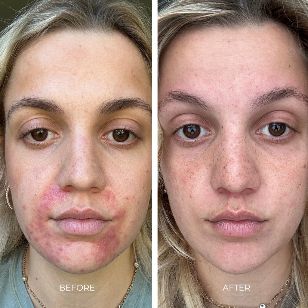 3% Sulfur Cleanser
