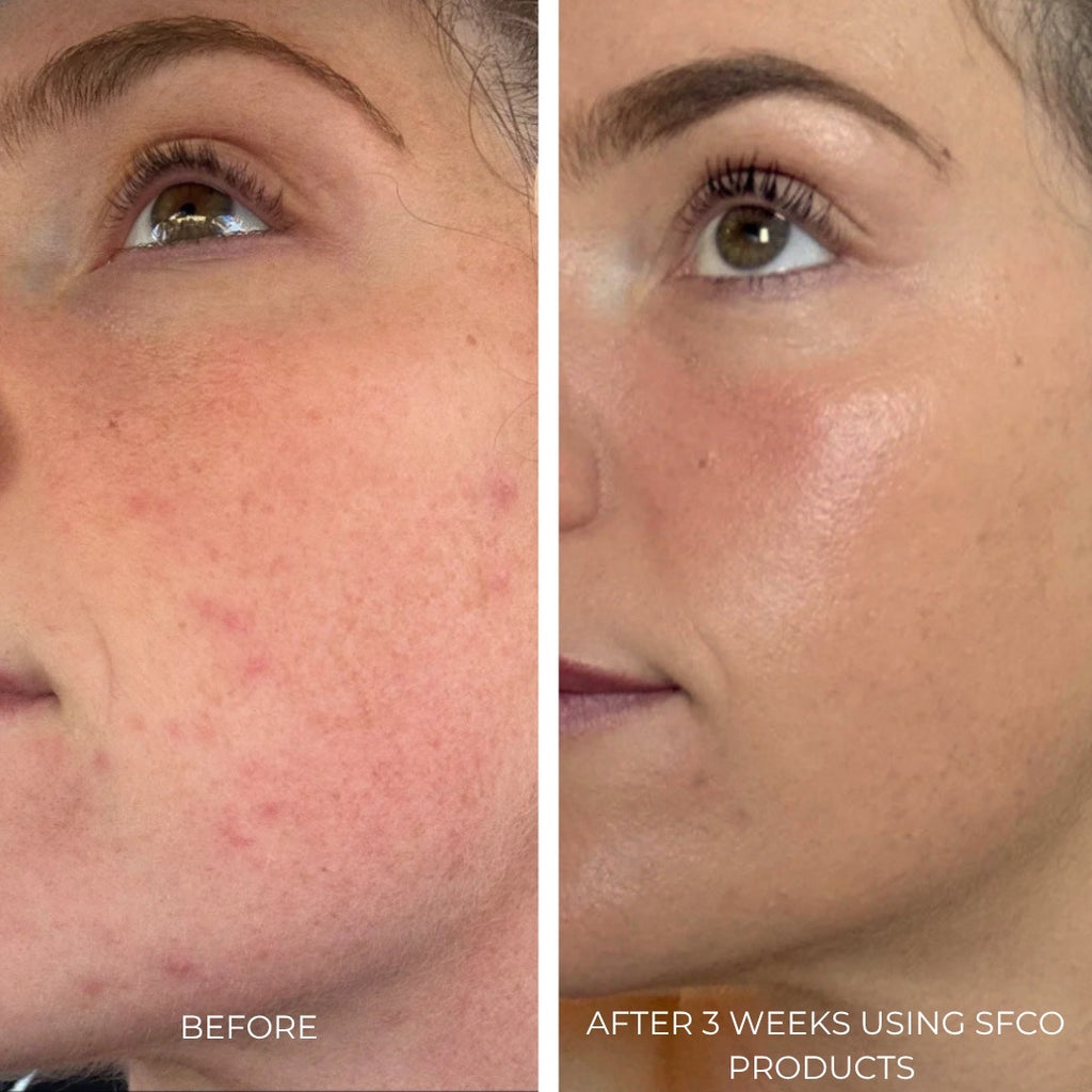 Soothing Microbiome Gel Creme