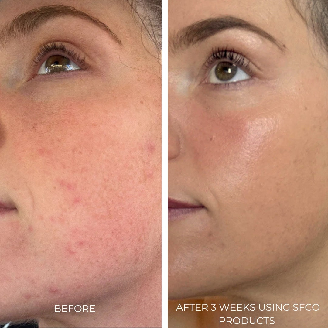 Soothing Microbiome Gel Creme